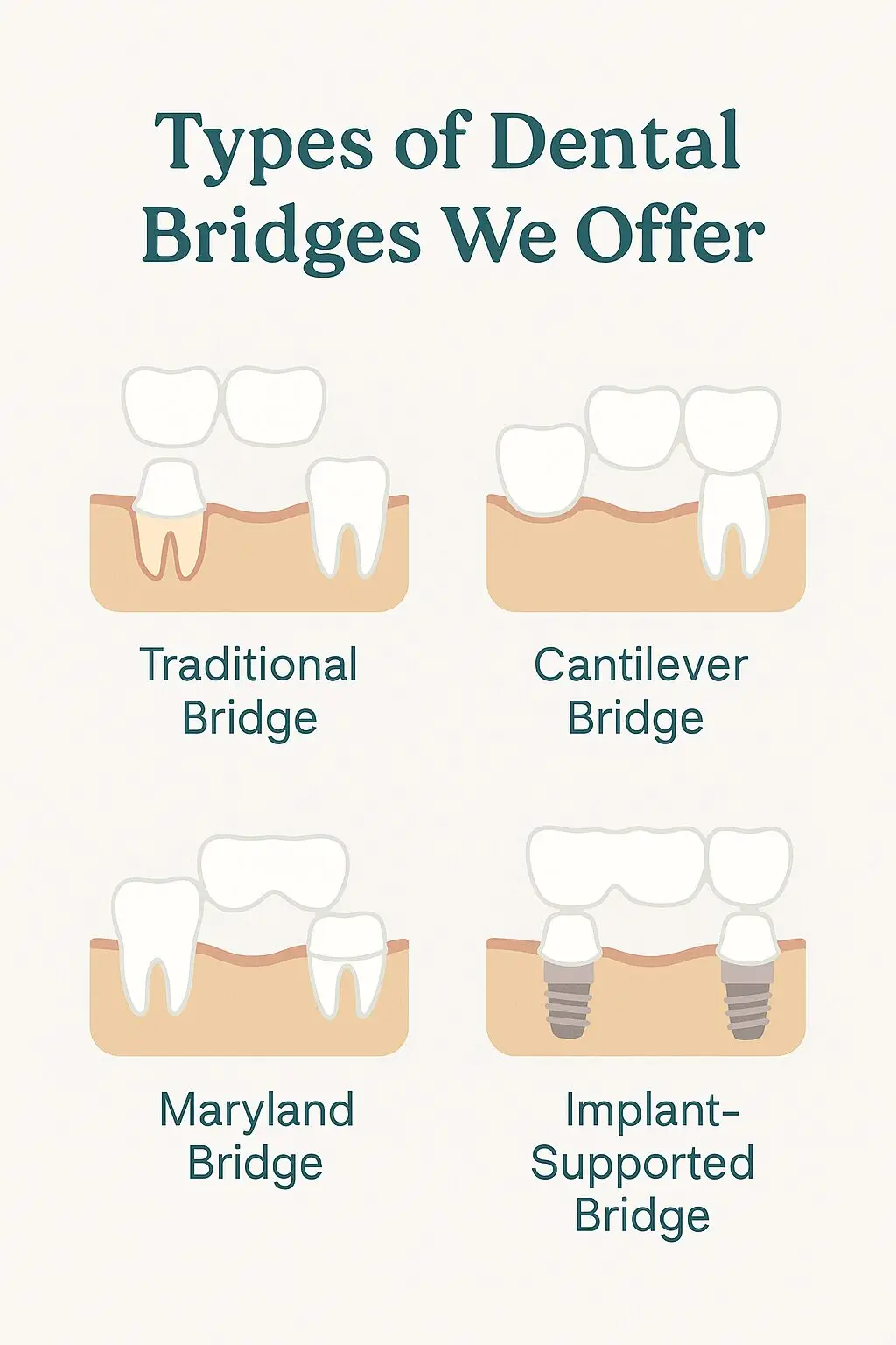 Dental Bridges Queens NY | Briarwood Dental Care