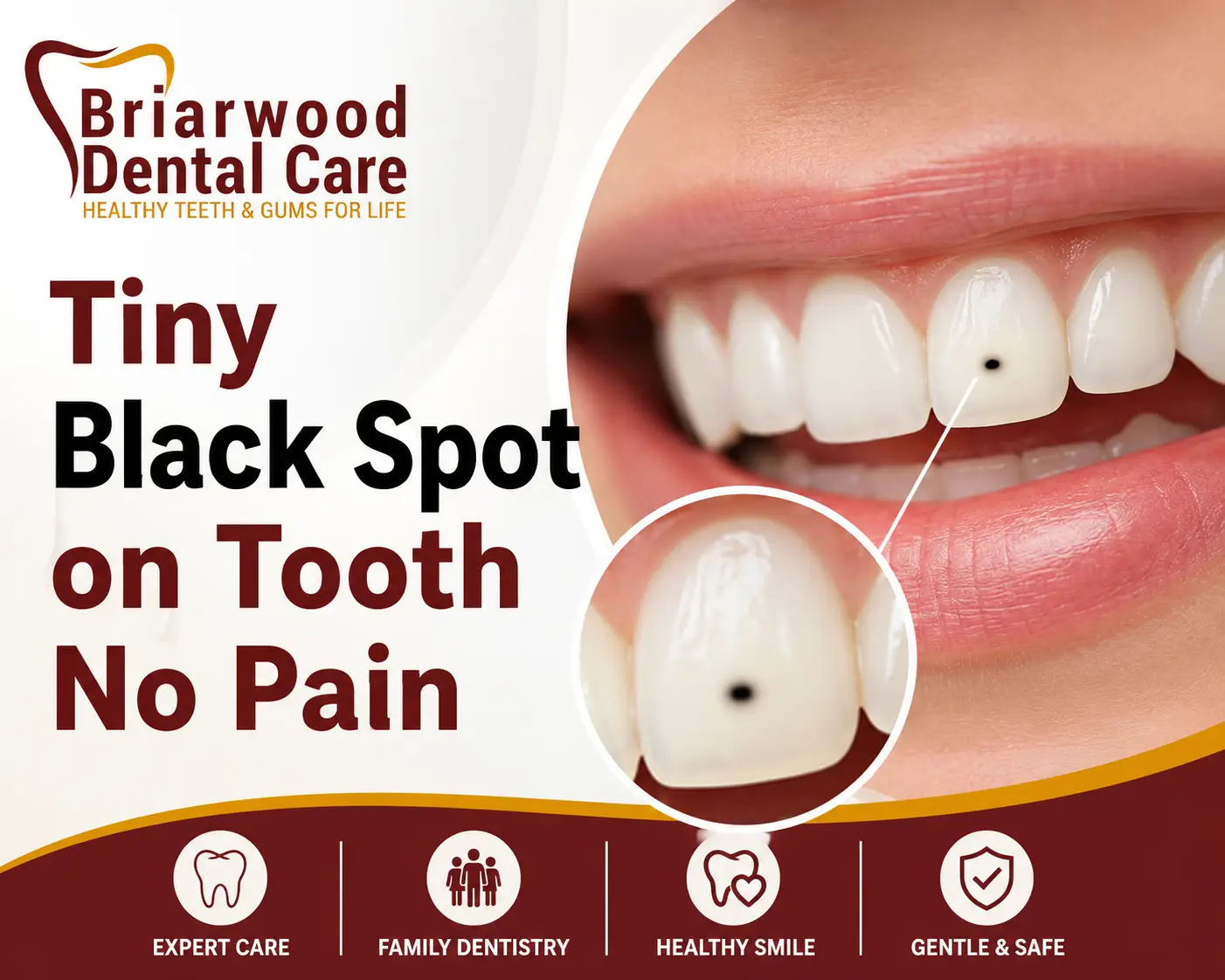 Tiny Black Spot on Tooth No Pain